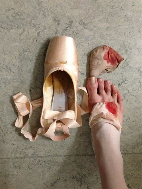 dancer problems on Tumblr