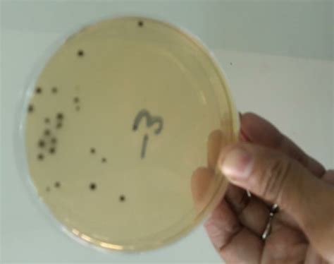 count of C.perfringens diluted 10 3 times without adding B. subtilis ...