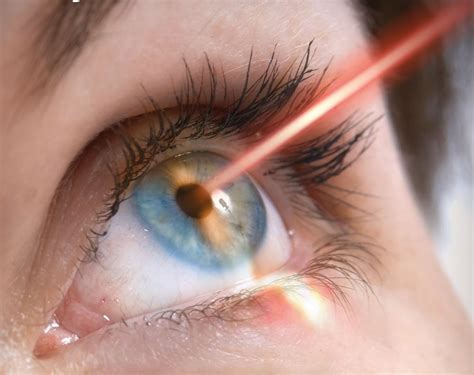 Advantage and Disadvantage of Laser Eye Treatment