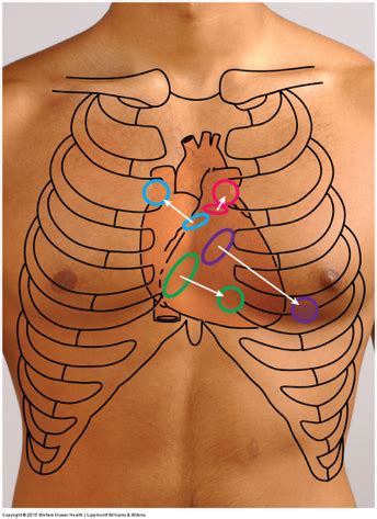 Heart Valves Location