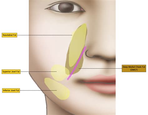 #4-1. Mid Face: Nasolabial fold | D&PS | Nasolabial folds, Face fillers, Aesthetic medicine