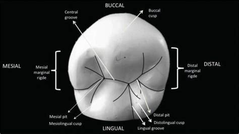 The Permanent Maxillary and Mandibular Premolar Teeth | IntechOpen | Dental anatomy, Dental ...