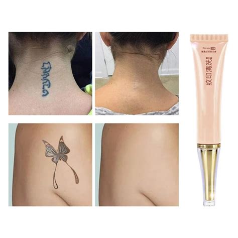 Details more than 76 pain free tattoo cream latest - thtantai2