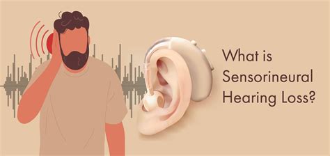 What is sensorineural hearing loss and how can it be treated?