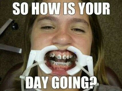 me on the 30th | Braces humor, Dental jokes, Dental meme