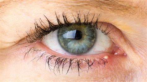 Here's What's Really Causing Your Stye