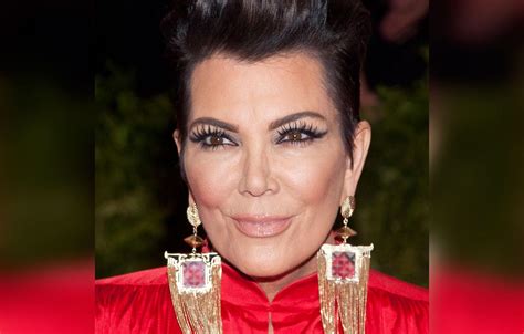 Kris Jenner's Plastic Surgery Makeover Exposed By Top Docs