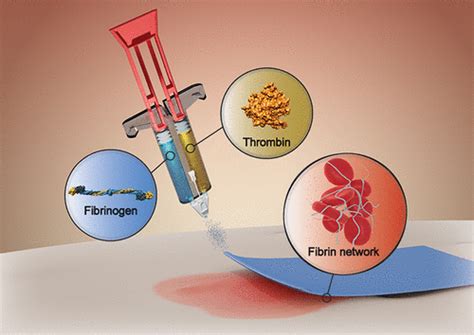 Fibrin Sealants: Challenges and Solutions | ACS Biomaterials Science & Engineering