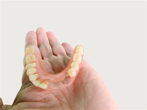 When dentists should use flexible partial dentures - Dandy