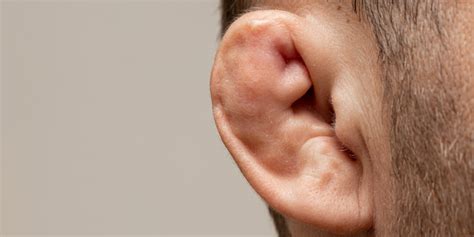 Treatment and Prevention of Cauliflower Ear | Sterosport