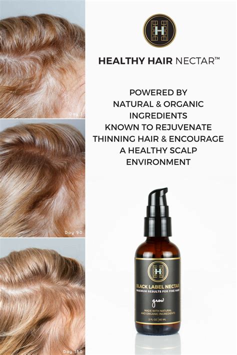 Thinning Hair Treatment - fashionnfreak