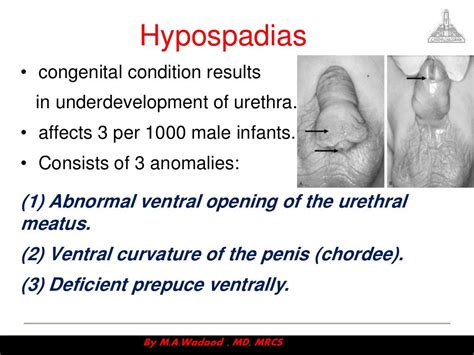 Congenital anomalies ppt