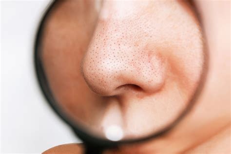 Clogged pores on nose: how to prevent and clean it? — AENO