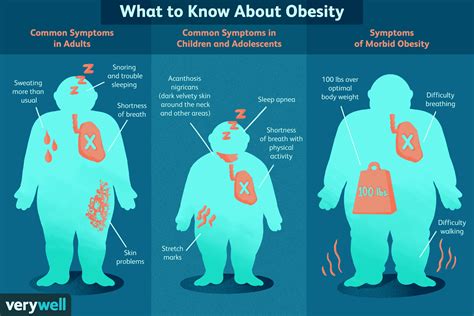 How Obesity is Diagnosed