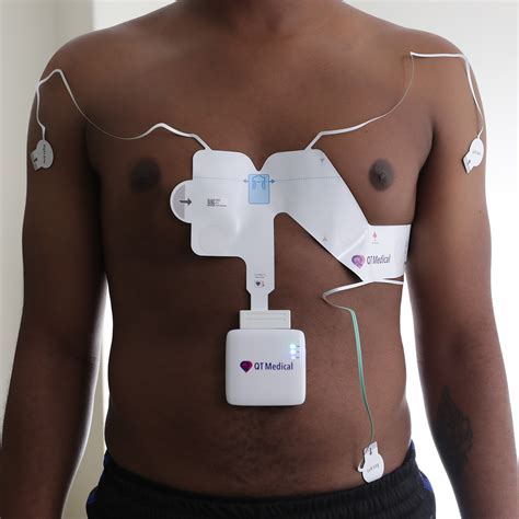 PCA 500 12-Lead Portable ECG Test by QT Medical