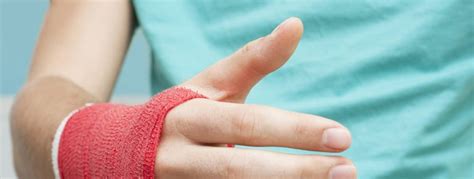 Will I Need Surgery on My Broken Or Fractured Finger? - Orthopedic & Sports Medicine