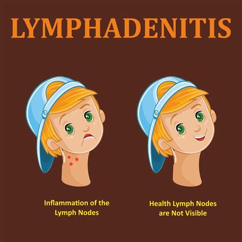 Is your child having enlarged Lymph Nodes or Lymphadenitis - Dr. Ankit ...