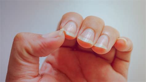 What Causes Your Nails To Split - And How Can You Prevent It?