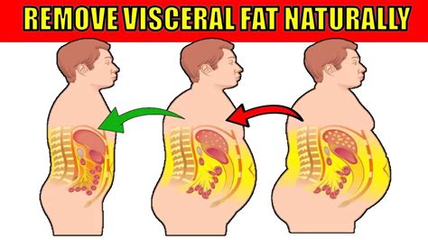 How to Get Rid of Visceral Fat Naturally - Epic Natural Health