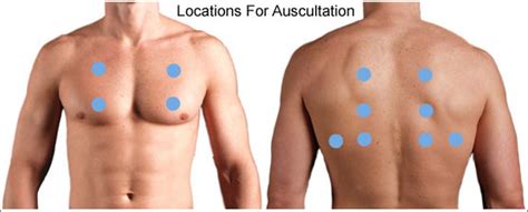 Where to auscultate lung sounds