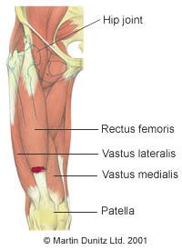 Thigh Muscle Strain Injury Guide | PhysioRoom Injury Advice