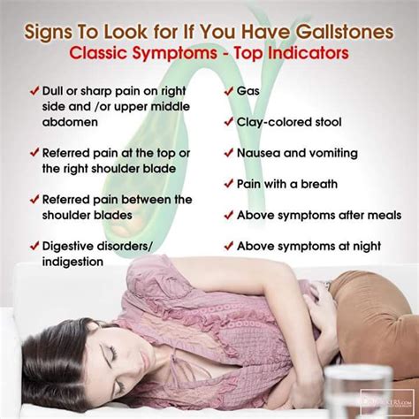 Simptomts-gallstones | Gallstones, Gallbladder symptoms, Gallbladder