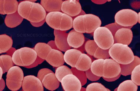 Lactococcus - MRGI - Microbiota Research Group of Iran