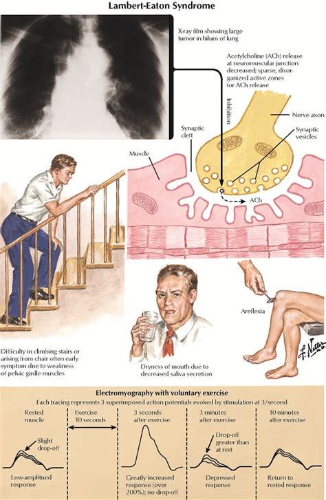 Neuromuscular Junction - Practical Psychology