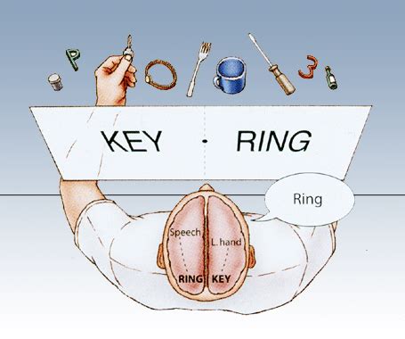 Split Brain Knowing Neurons – Knowing Neurons