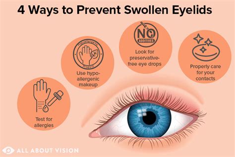 Swollen Eyes: Symptoms, Causes, Treatment, Medicine, Prevention, Diagnosis | truongquoctesaigon ...