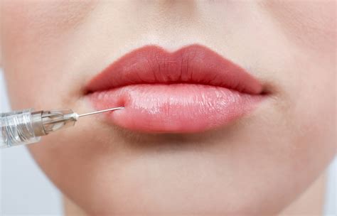 Russian Lips vs. Traditional Filler — Urban You - Modern Beauty + Wellness