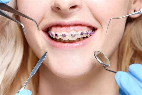 What Is Orthodontics? A Complete Guide | Thompson Creek Dental