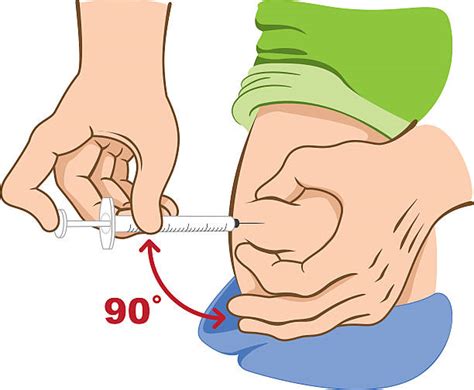 Intramuscular Injections Illustrations, Royalty-Free Vector Graphics ...