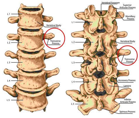 Transverse Process Fractures. A Broken Spine From Crashing