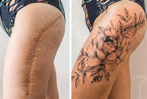 16 People Who Transformed Their Scars Into Pieces of Art / Bright Side