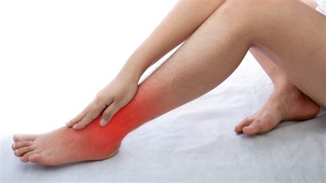 Causes and treatments for varicose veins around ankles - Kafri