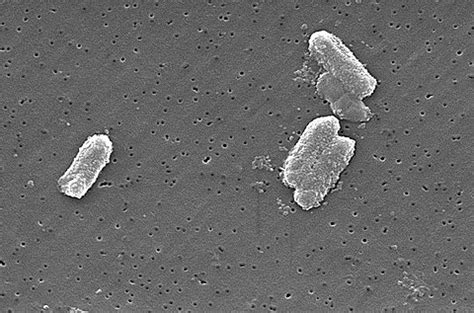 Citrobacter – Wikipedia, wolna encyklopedia