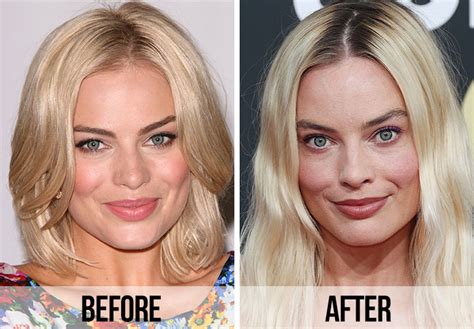 Fans Spot A ‘Huge Difference’ In Margot Robbie’s Appearance After Looking At Before And After ...