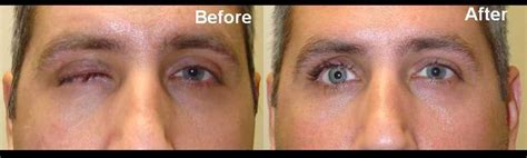 Eye socket surgery and prosthetics are one of Taban MD's many ...