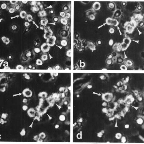 Formation of aggregates and syncytia by cell fusion, as visualized by ...