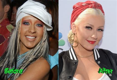 A Take on Christina Aguilera Plastic Surgery