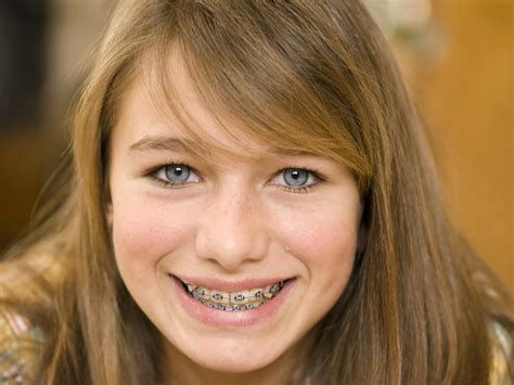 Close Up Smiling Girl with Braces - Hardy Pediatric Dentistry & Orthodontics