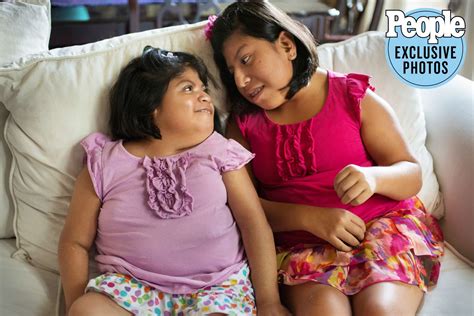 Formerly Conjoined Twins Teresa and Josie Turn 21: Inside Their Incredible Journey