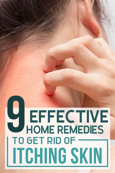 9 Effective Home Remedies To Get Rid Of Itching Skin