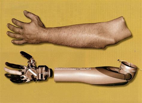 Bionic Arm 2.0, created by an international team led by the Johns Hopkins University Applied ...