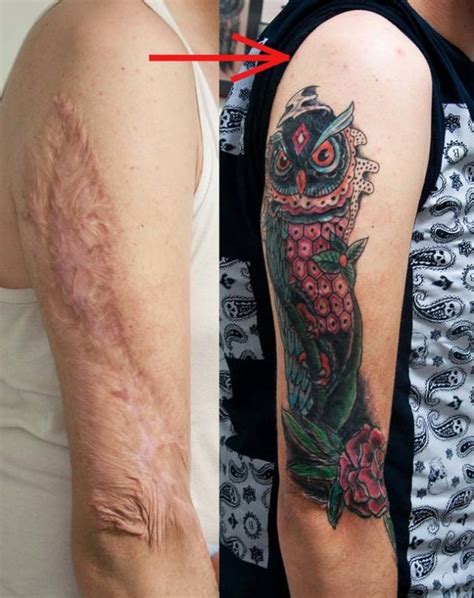 Come coprire una cicatrice con un tatuaggio