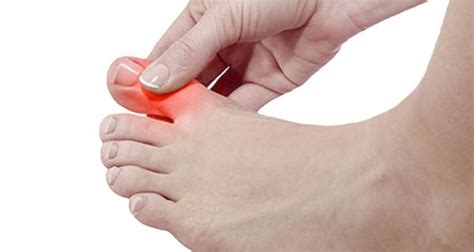 Toe Pain - Symptoms, Causes and Treatment