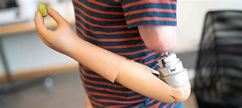 Robotic Prosthetic Arm Cost : Hackberry Is A Practical Prosthesis For ...