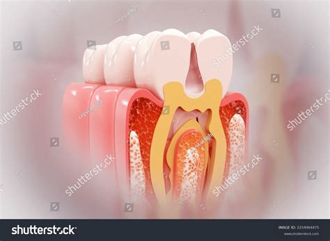 Dental Anatomy Diagram 3d - vrogue.co