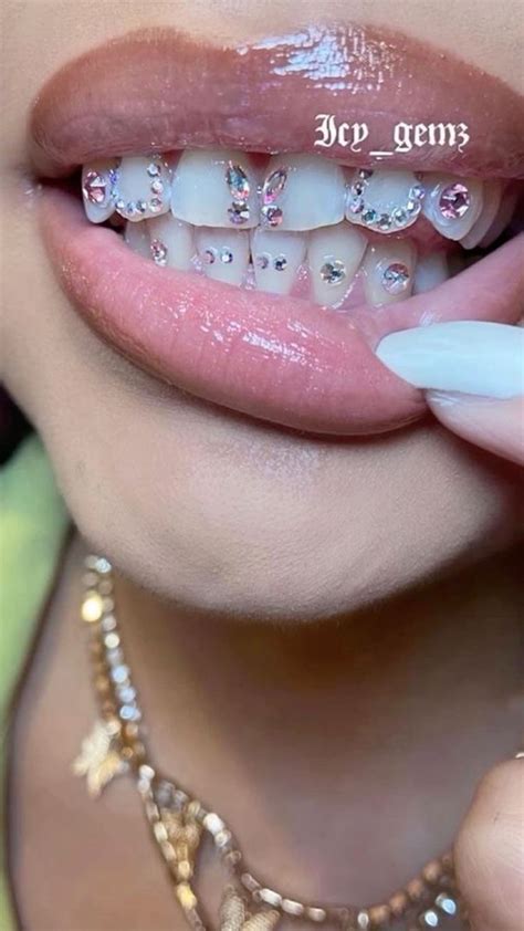 Pin by Cally_basaki on Épingles créées par vous in 2023 | Teeth jewelry, Diamond teeth, Dental ...